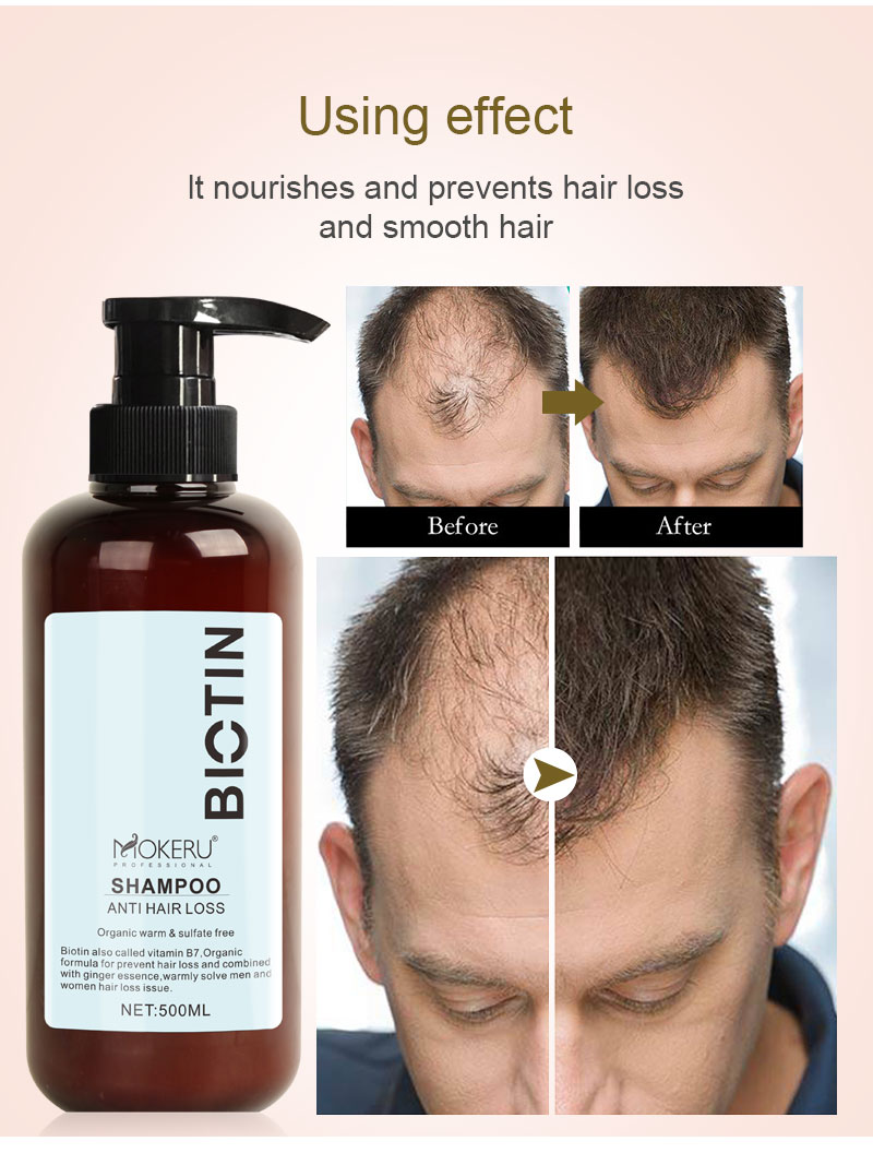 Biotin hair shampoo