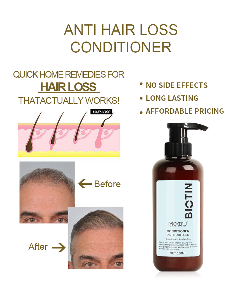 Anti hair loss conditioner