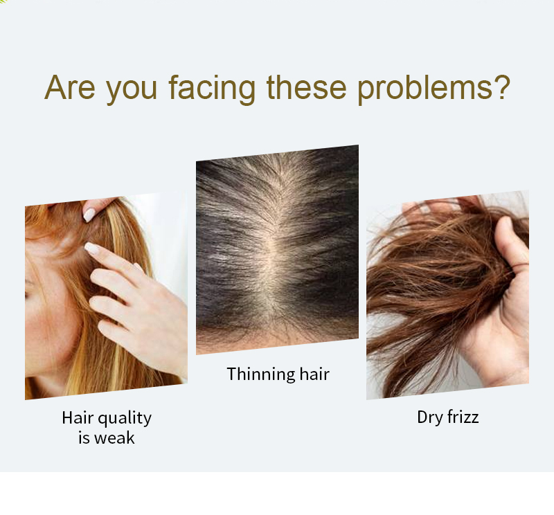 Anti hair loss conditioner