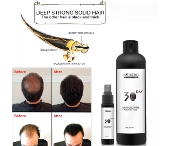 Herbal Hair Regrowth Oil